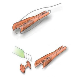 Kónické rebríčky Kónické rebríčky